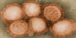 An image of the A(H1N1) influenza, or Swine flu, virus