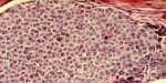 Breast cancer cells 700 | @photo_journ's newsblog by John Le Fevre